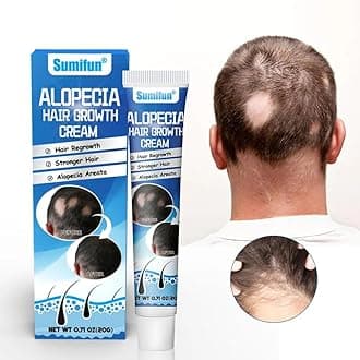 NIKITA.VIVI Hair Growth Cream, Alopecia Hair Growth Cream, Hair Regrowth Treatment Cream, Promoting Hair Growth & Effective Treatment for Alopecia & Thinning Hair 20G