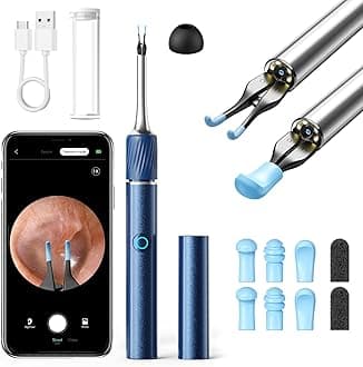 Qimic Ear Camera with Tweezers - Ear Cleaner with Camera,1080P HD Earwax Removal Tool with Light, IP67 Ear Cleaning Kit with 6 Ear Spoon, Ear Camera Otoscope for iPhone, Android